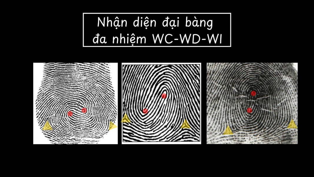 Chủng đại bàng đa nhiệm WC - WD - WI (Whorl Double Loop)